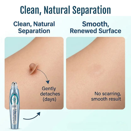 💧Timilk® SpotlessPro Advanced Skin Care Pen