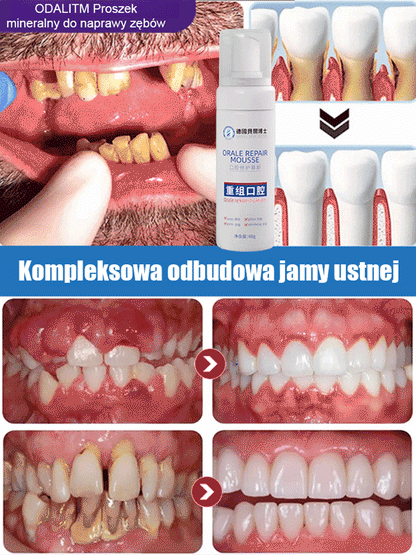 Medyczna pianka regeneracyjna do jamy ustnej klasy medycznej