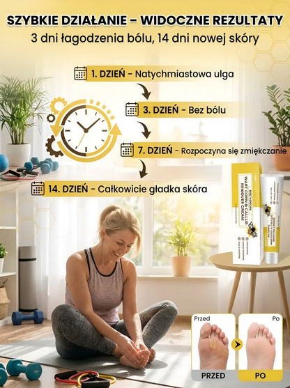 Krem do usuwania modzeli i odcisków z jadem pszczelim