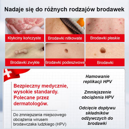 【Jednosekundowy usuwacz brodawek】Krem do usuwania brodawek