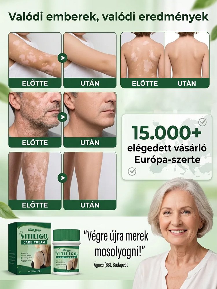 Bezhormonalny krem do pielęgnacji białych plam, szybkie działanie