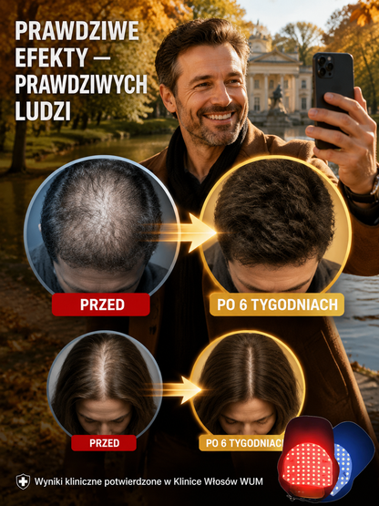 【Przeznaczone wyłącznie dla umiarkowanego i zaawansowanego wypadania włosów】Profesjonalny technologi