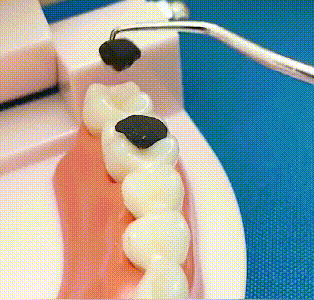 🦷Zestaw wykałaczek ze stali nierdzewnej