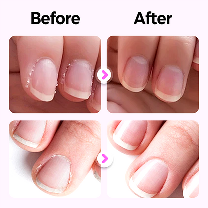 【Kup 1 i otrzymaj 2 gratis】💜 3 w 1 Pióro do pielęgnacji paznokci
